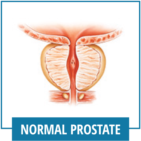 Normal Prostate